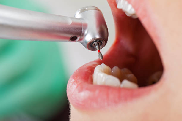 Best Urgent Care for Lost Fillings or Crowns in Kayenta, AZ